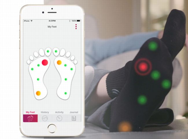 スマート靴下で糖尿病の足潰瘍を予防する