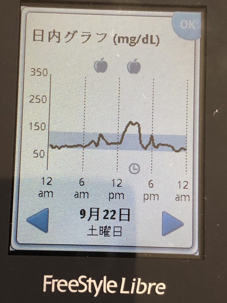 1日目フリースタイルリブレ：食後高血糖を測定