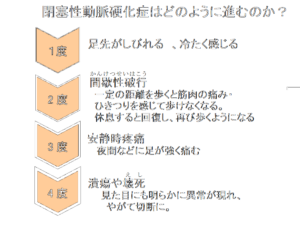 糖尿病の足切断は合併症による