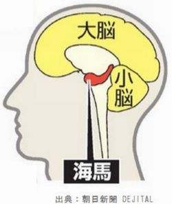 糖尿病で脳が萎縮して認知症になる