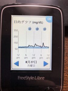 リブレを使った血糖測定で日内変動が明らかに