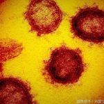 新型コロナ感染は糖尿病発症のリスクを高める